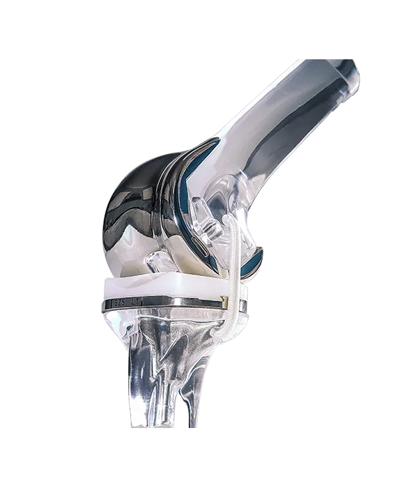 2.7.1_Orthopedics_Joint-Reconstr