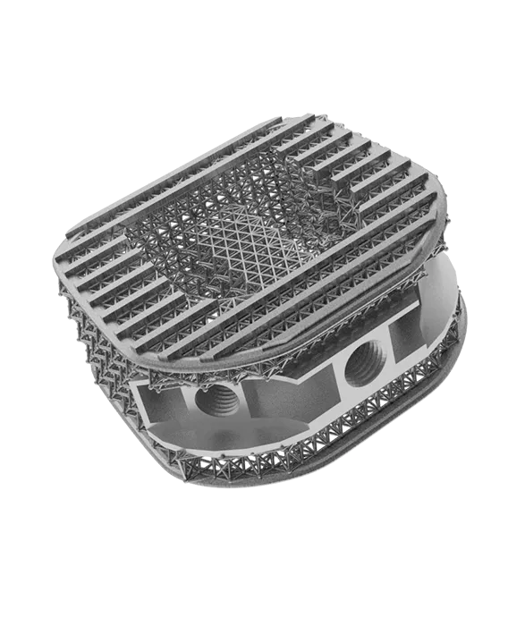 2.7.5_Manufactured-Parts_Laser-P